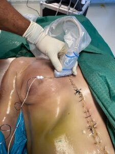 UPA-UltraDissection-Gallery- (7)