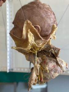 UPA-UltraDissection-Gallery- (8)