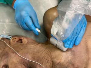 UPA-UltraDissection-Gallery- (9)