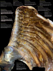 UPA-Ultradissection-Carrusel-anatomía- (15)