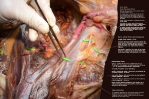 UPA-Ultradissection-Carrusel-anatomía- (16)