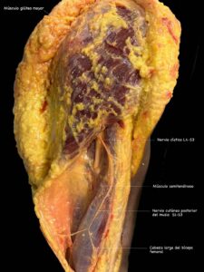 UPA-Ultradissection-Carrusel-anatomía- (17)