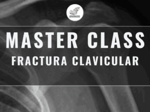 Masterclass 19 | Fractura Clavicular