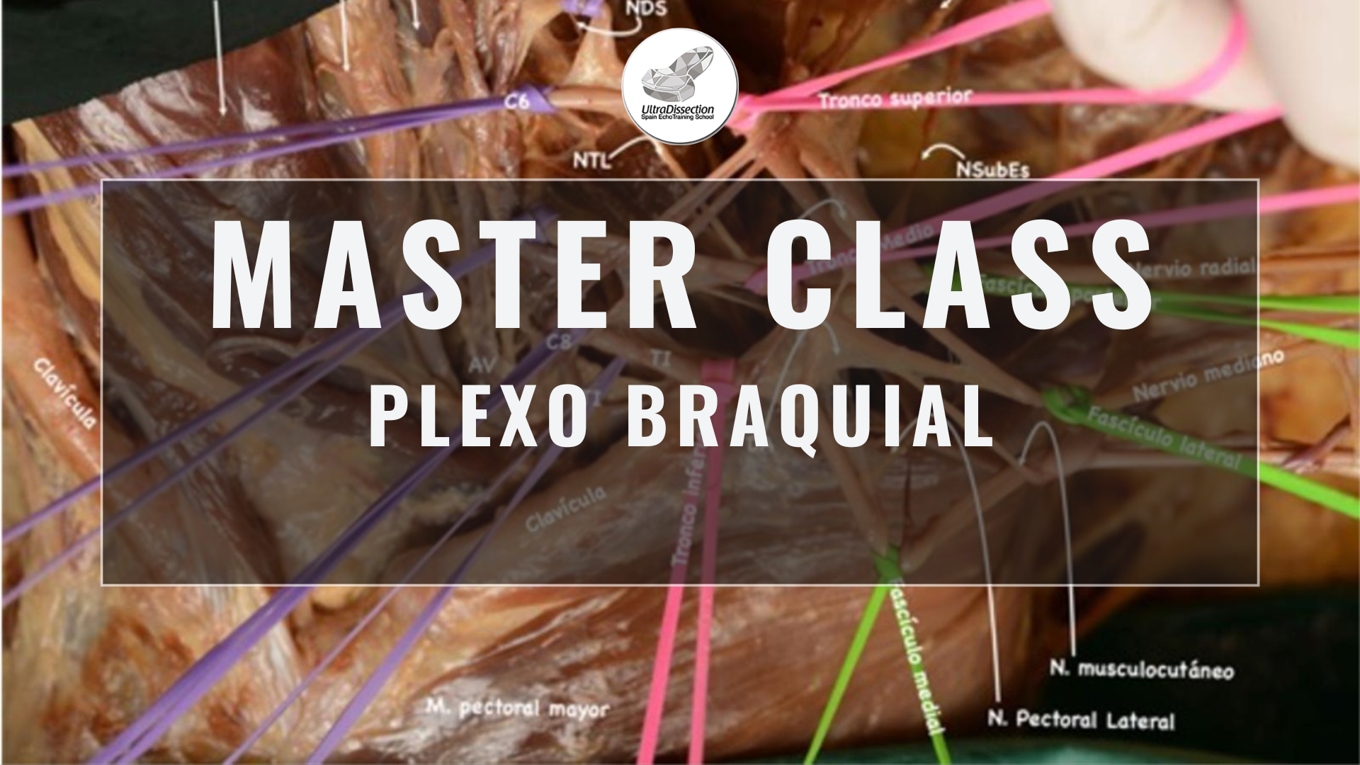 Masterclass 25 | Plexo Braquial