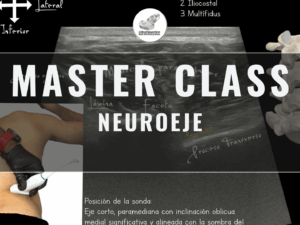 Masterclass 26 | Neuroeje