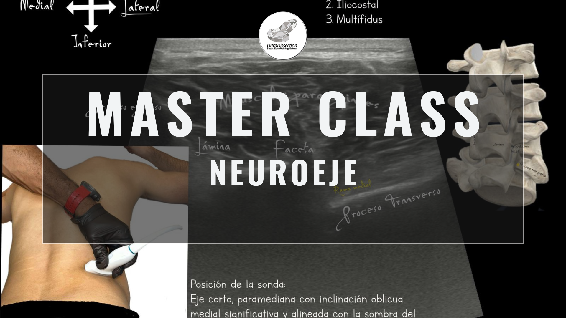 Masterclass 26 | Neuroeje