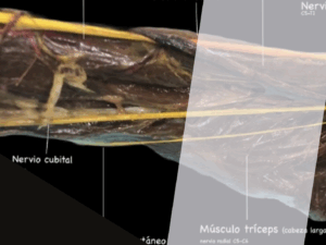 Libro Nervio cutáneo medial del brazo y nervio medial del antebrazo
