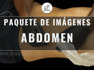 Paquete de Imágenes – Anatomía y Bloqueos Regionales del Abdomen (49+ recursos)