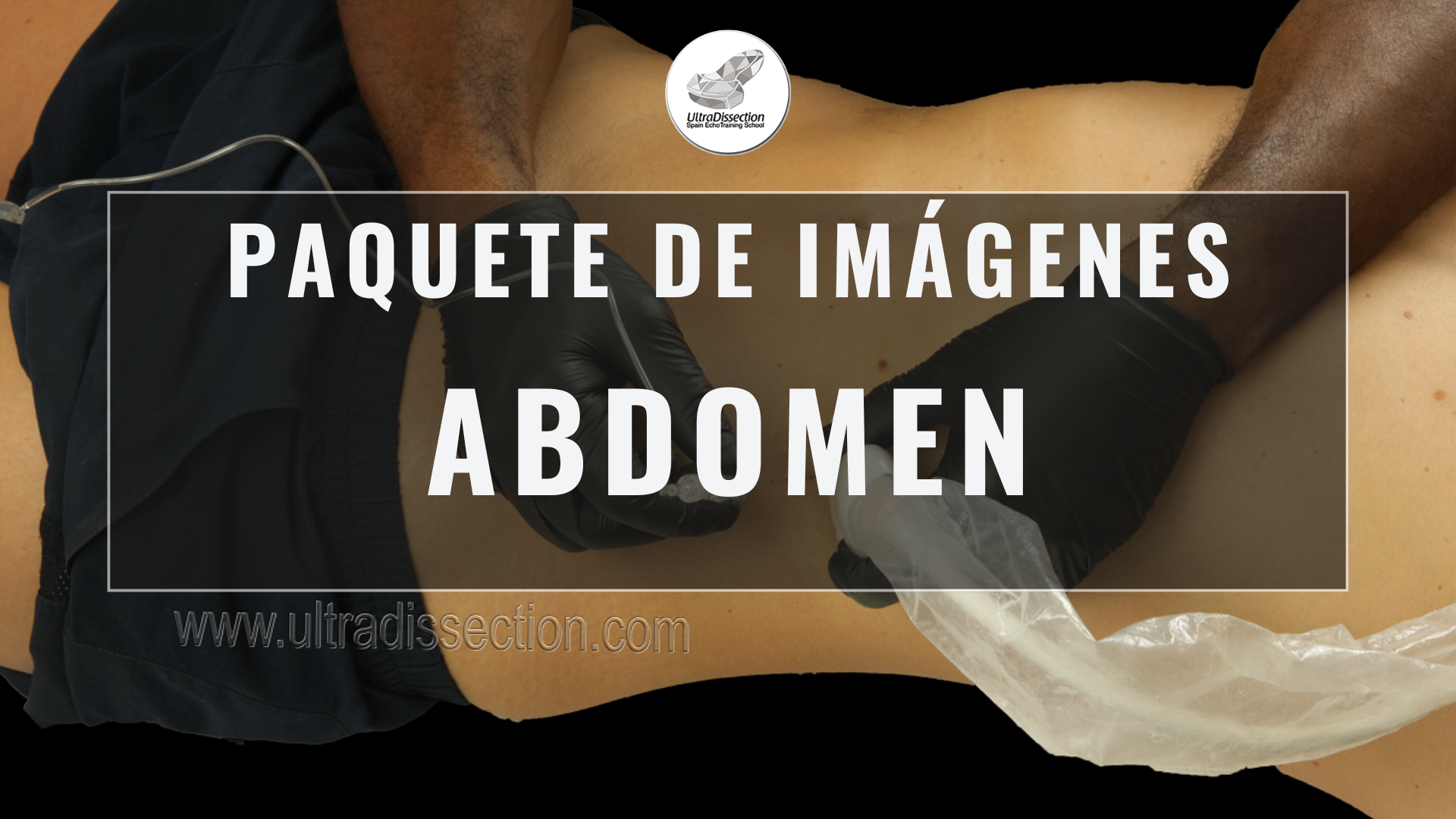 Paquete de Imágenes – Anatomía y Bloqueos Regionales del Abdomen (49+ recursos)