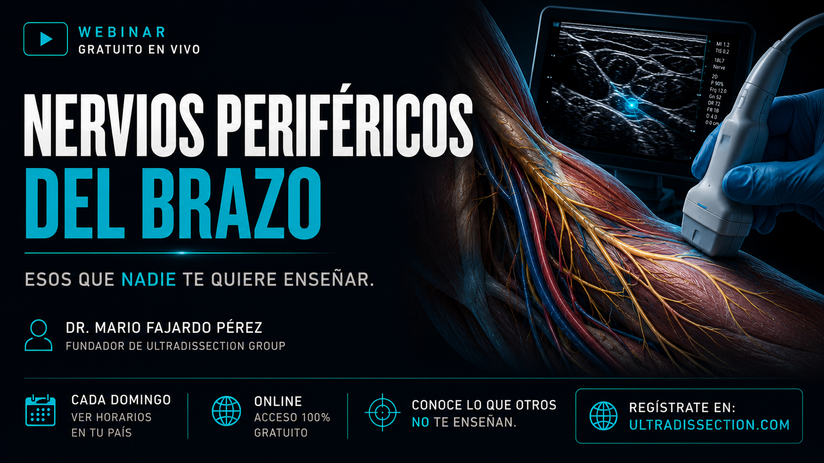 Nervios Perifericos del Brazo