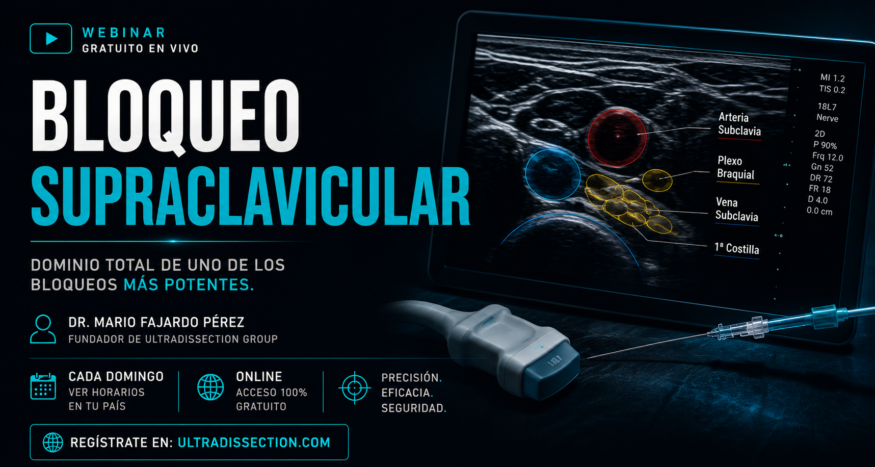 Bloqueo Supraclavicular