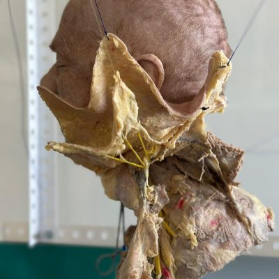 UPA-UltraDissection-Gallery- (8)