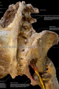 UPA-Ultradissection-Carrusel-anatomía- (14)