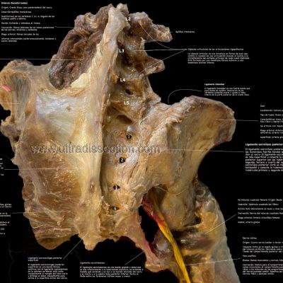 UPA-Ultradissection-Carrusel-anatomía- (14)