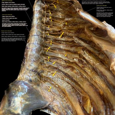 UPA-Ultradissection-Carrusel-anatomía- (15)