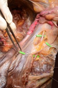 UPA-Ultradissection-Carrusel-anatomía- (16)