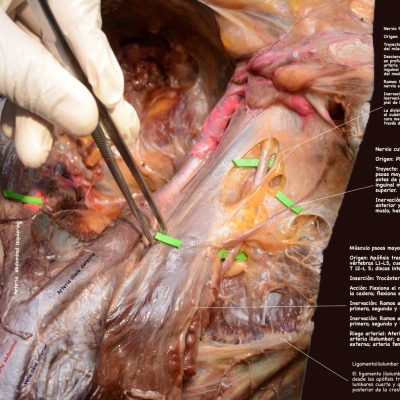 UPA-Ultradissection-Carrusel-anatomía- (16)