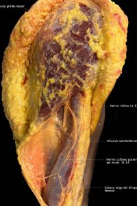 UPA-Ultradissection-Carrusel-anatomía- (17)