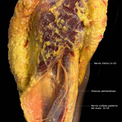 UPA-Ultradissection-Carrusel-anatomía- (17)